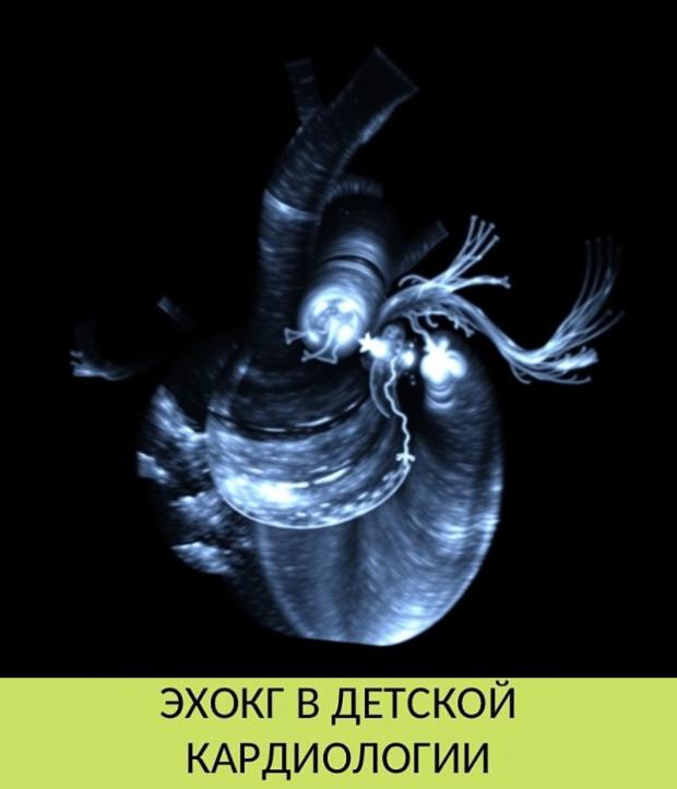 ЭХОКГ в детской кардиологии ЭХОКГ в детской кардиологии