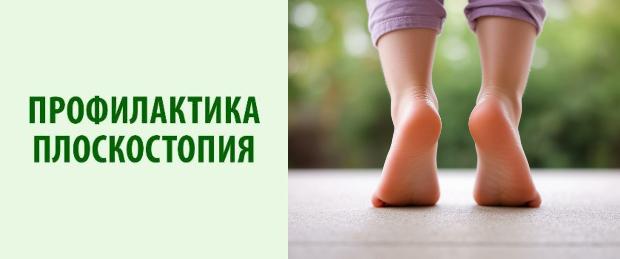 Как не допустить плоскостопия Как не допустить плоскостопия