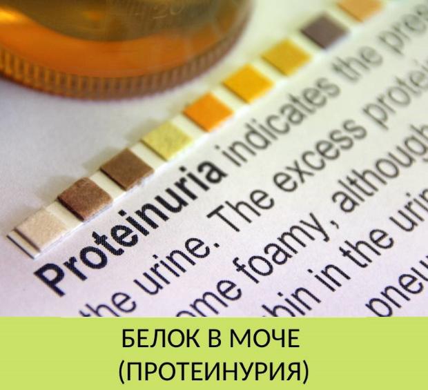 Белок в моче у ребенка Белок в моче у ребенка