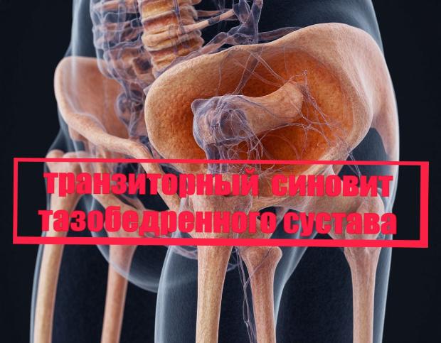 Медицинский ликбез. Транзиторный синовит Медицинский ликбез. Транзиторный синовит