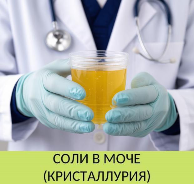 Соли в моче у ребенка Соли в моче у ребенка